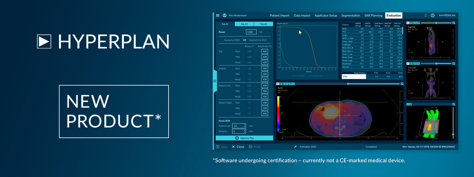 HyperPlan® Planungssoftware