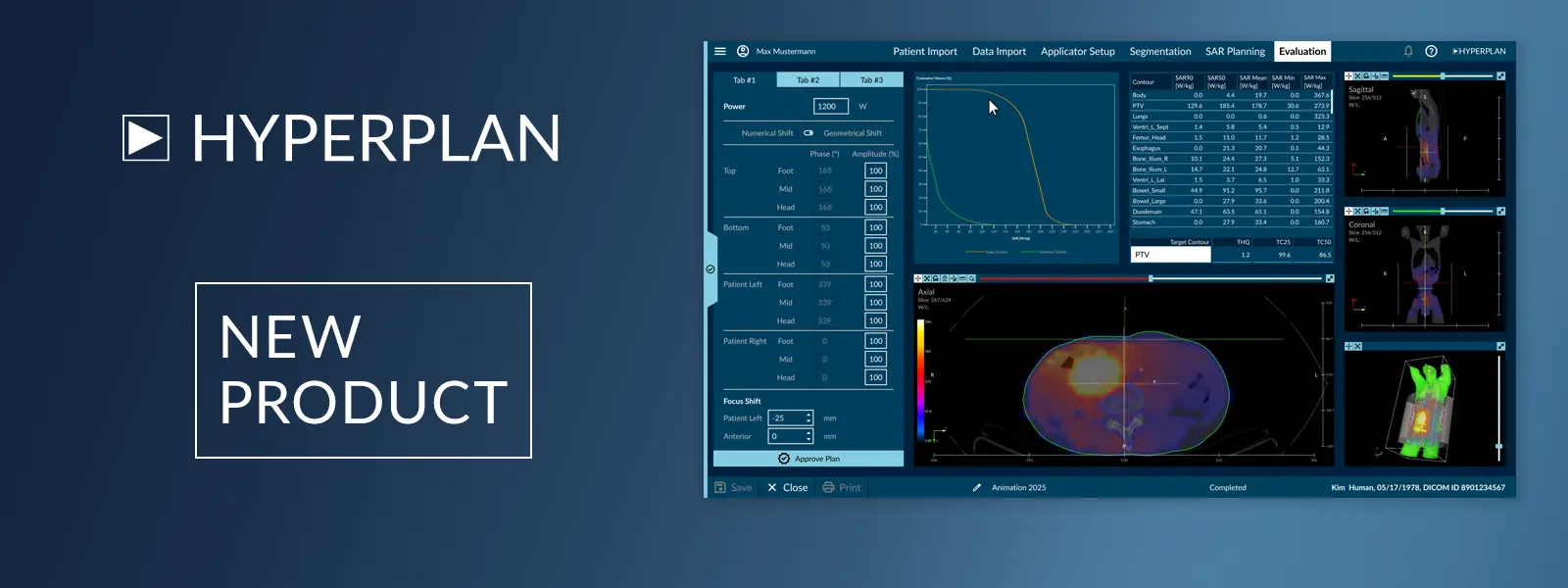 HyperPlan® Software