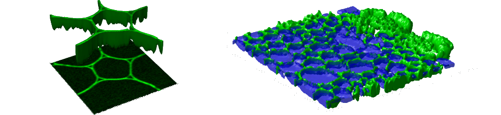 Stimulated Raman Scattering Mikroskopie mit Alpha CRS