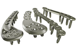 Orthopädische Platten
