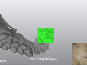 3D-Scan-Beispiel