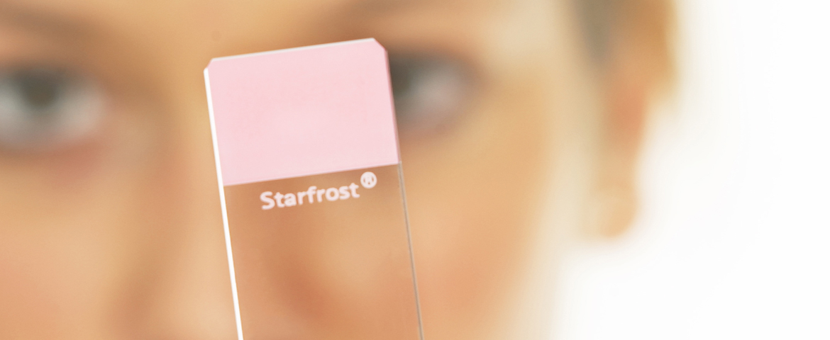 StarFrost® Objektträger mit Farbmarkierung