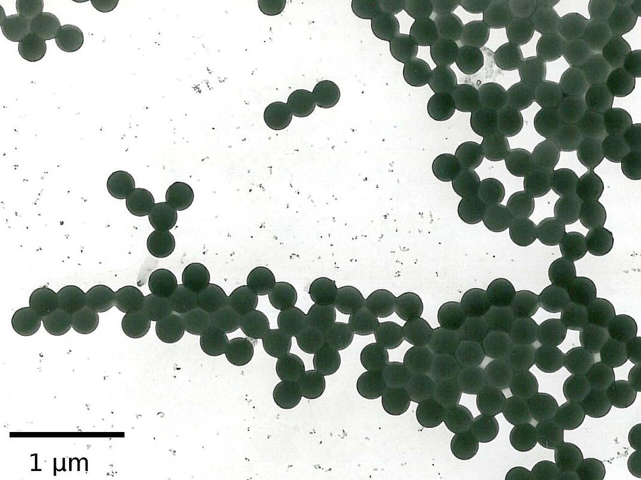 Materialcharakterisierung per Elektronenmikroskopie