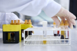 Immunologische Laboruntersuchungen