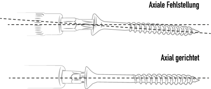 TOBI®-Drive-System