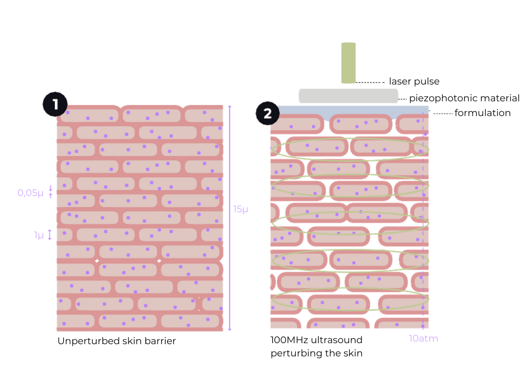 Skin-Barrier-Schema Technologie