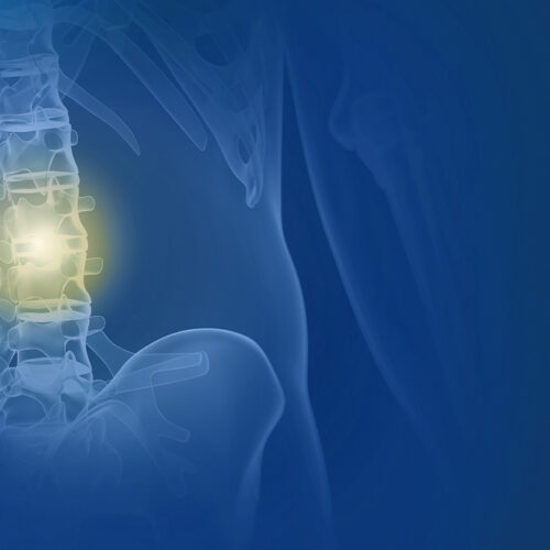 Radiofrequenztherapie
