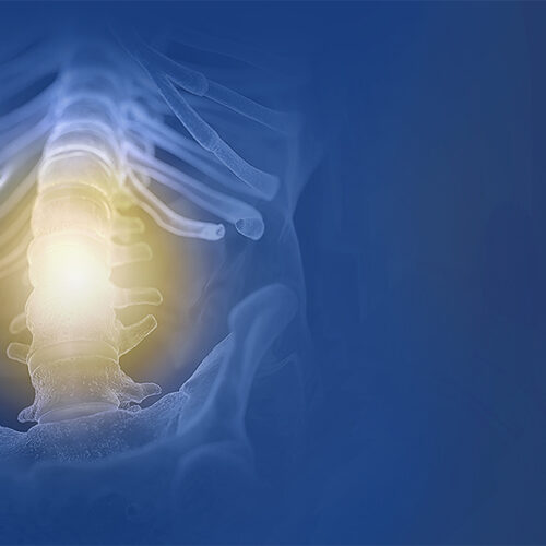 Epidurale Adhäsiolyse