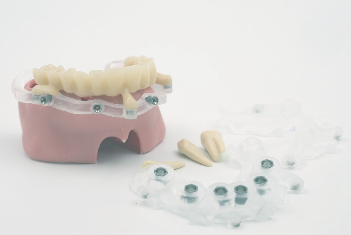 Digital Advanced Guided Surgery