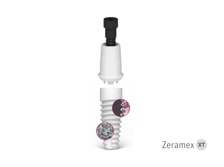 Implantatsystem mit prothetischen Komponenten