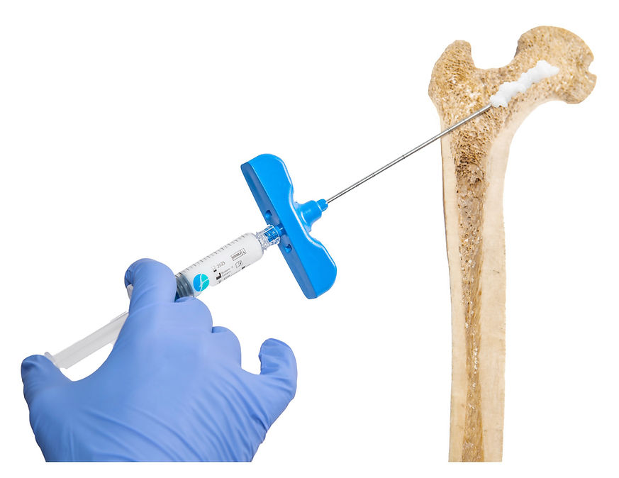 Injizierbares bioaktives Hydrogel zur Knochenregeneration