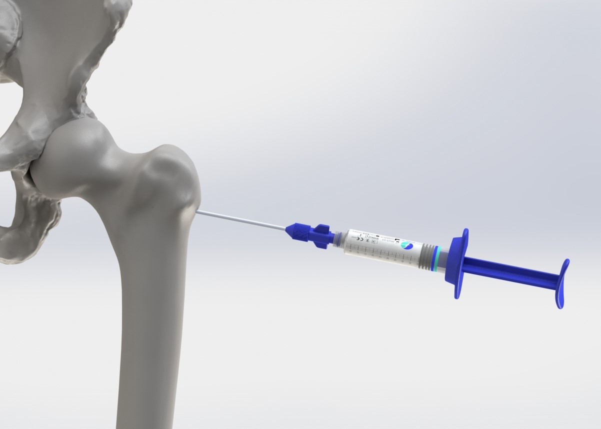 flowbone – EPFL Spin-off für Knochenregeneration