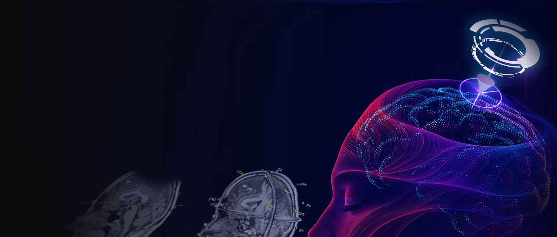 visor2 TMS-Neuronavigation