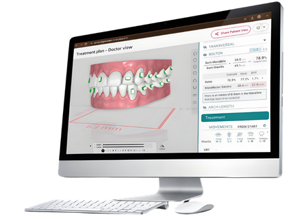 Dentaler Aligner-Tray