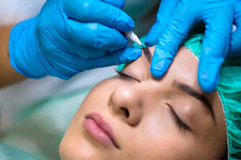 Microneedling