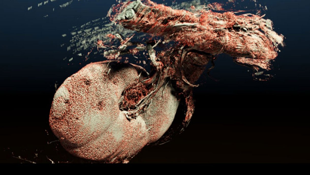 3D-Rekonstruktion aus histologischen Objektträgerbildern