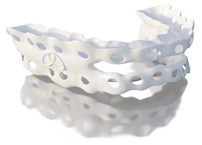 alwasleep-Schiene (Unterkiefer-Protrusionsschiene)