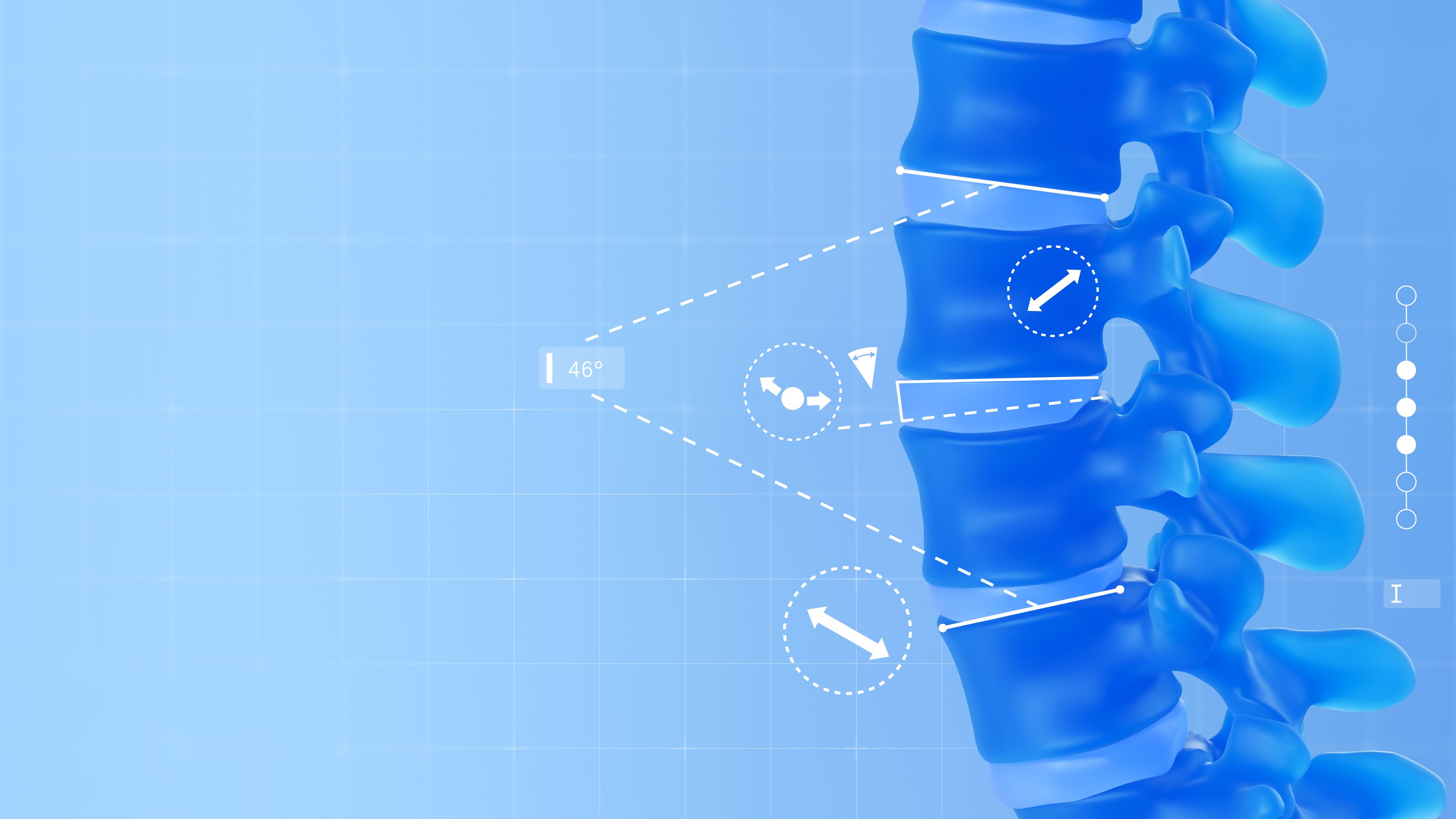 Spine Planning (Elements)