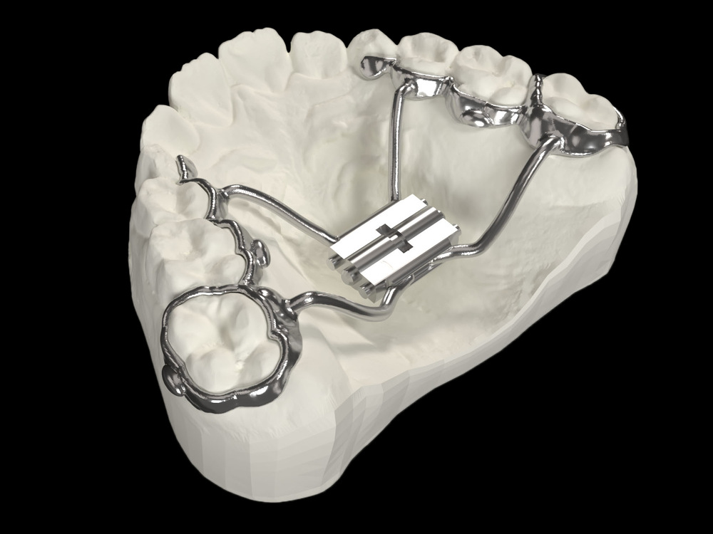 Multi-Fit3R
