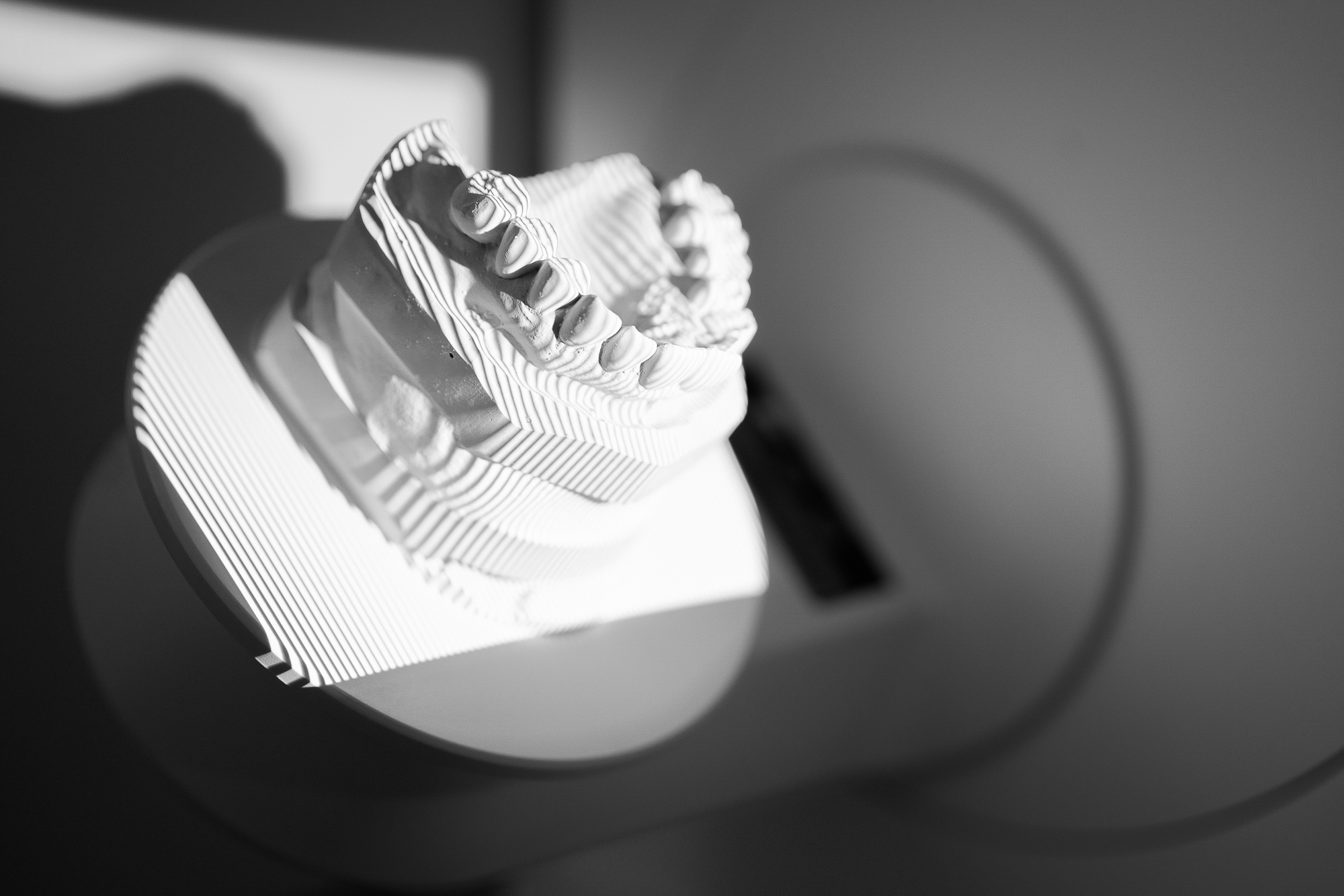 3D-Scan des Zahnmodells zur digitalen Weiterverarbeitung
