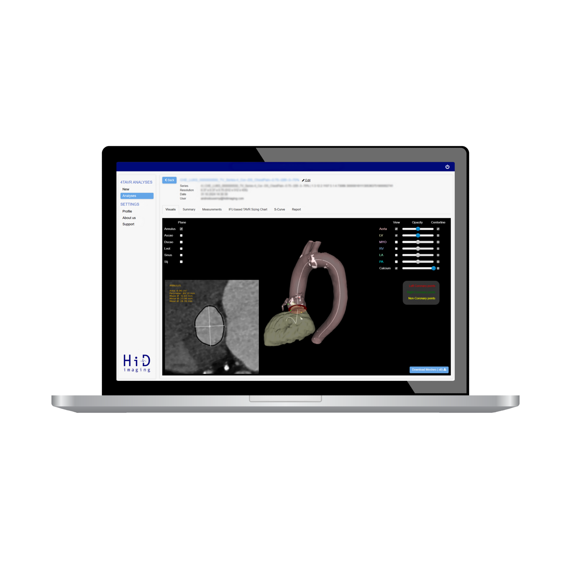4TAVR Software