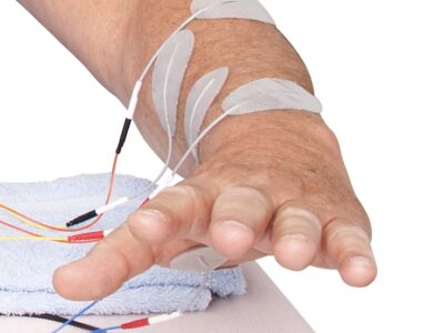 Hand öffnen mit Elektrostimulation