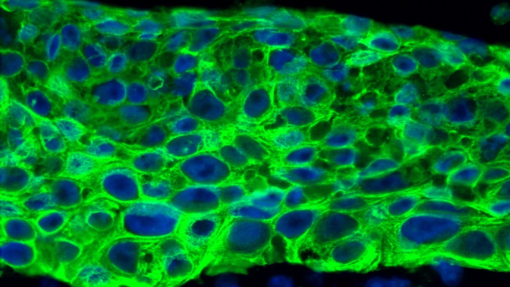 Bioapplikation: Gewebestrukturen (Cytokeratin 14)