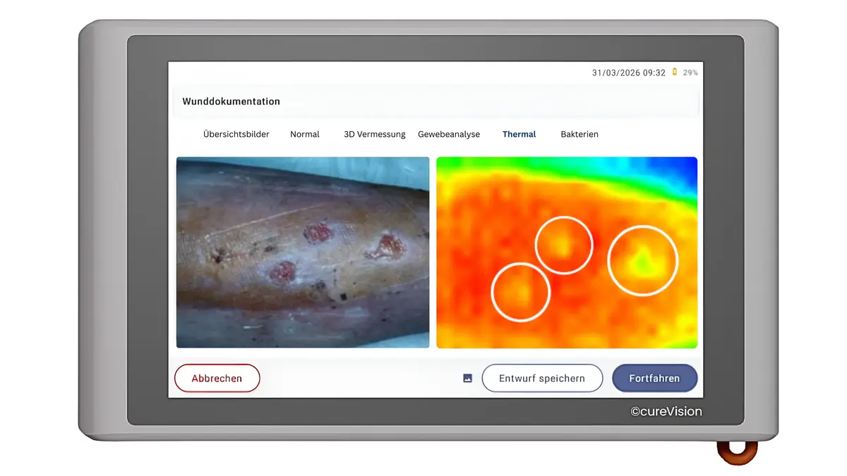 cureVision ThermoScan