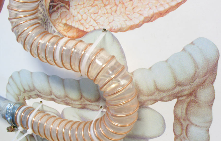 Minimal-invasive Medizinprodukte
