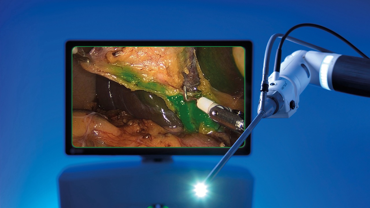 Vision Overlay des Versius Systems