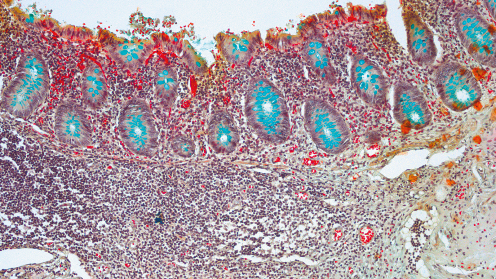 Histologie – Polymerisationssysteme