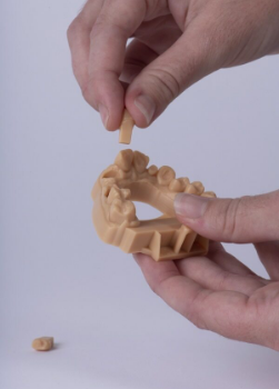 Dental-Modell (Aligner)