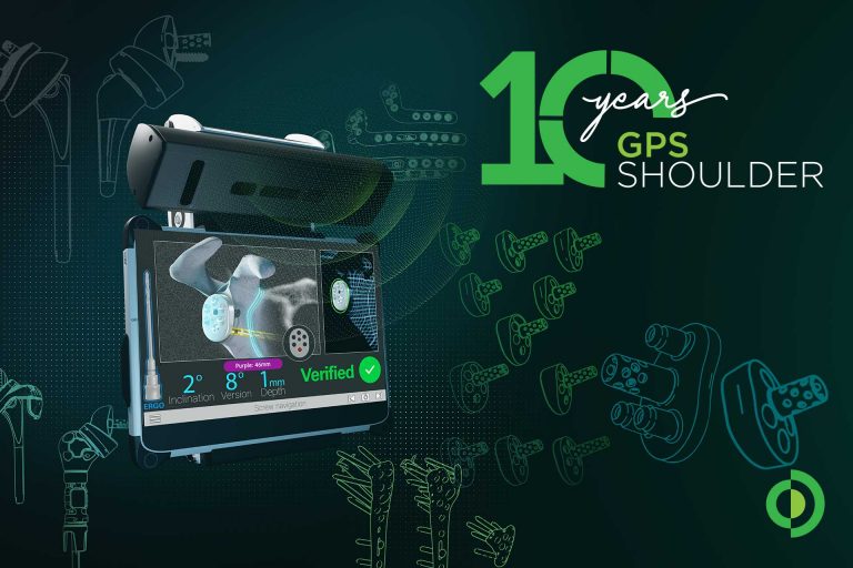 10 Jahre GPS Shoulder