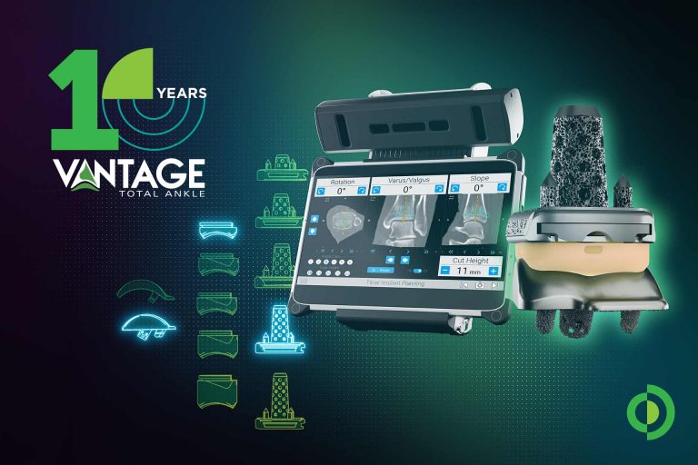 10 Jahre Vantage Ankle