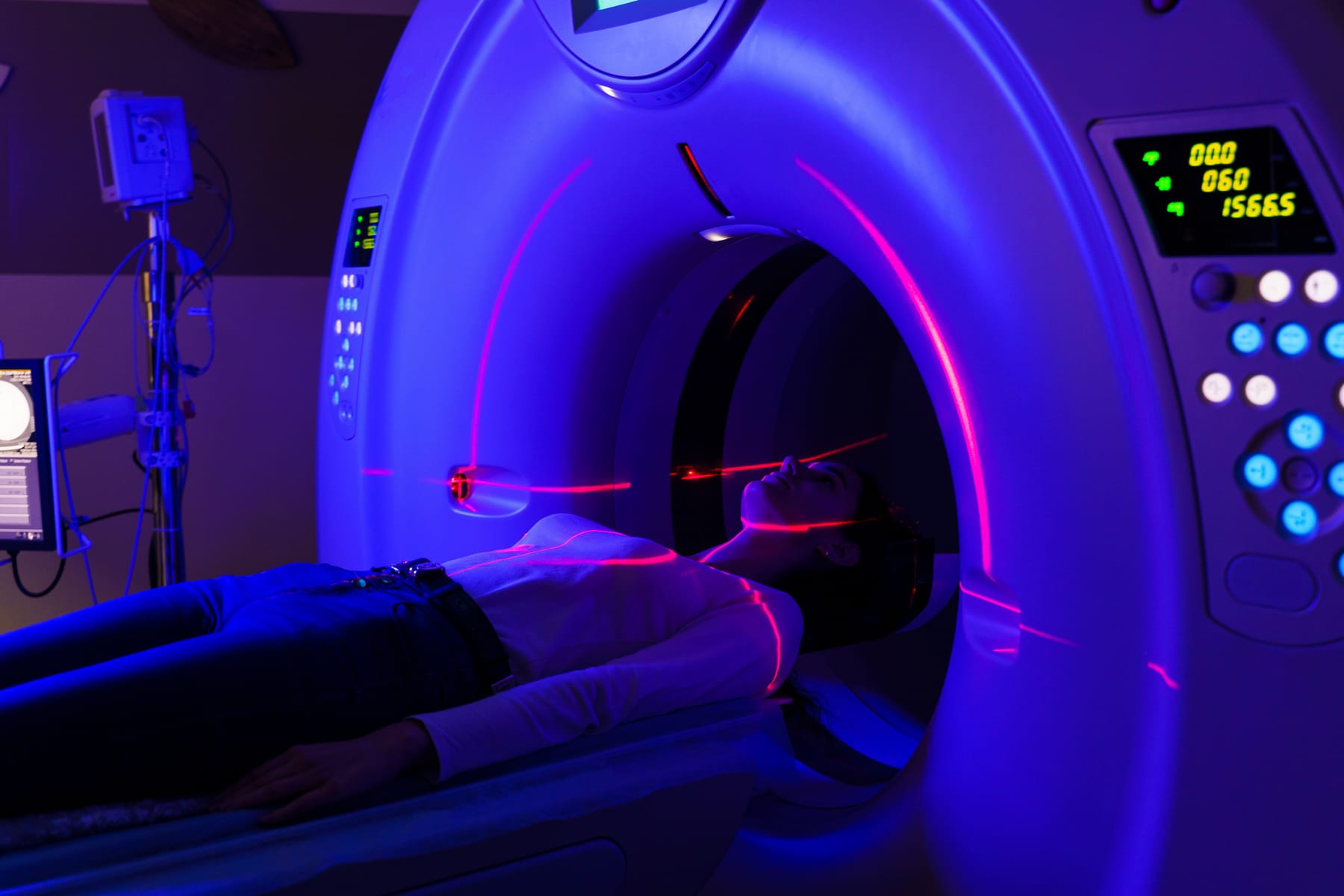 Laser-Linienscanner bei der Machine-Vision-Inspektion