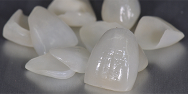Keramik Veneers