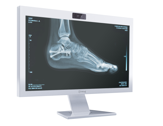 2D-Monitor