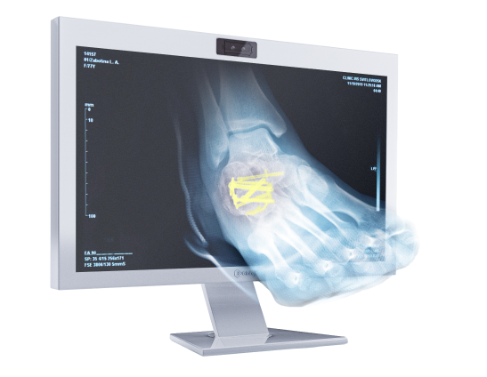 Brillenfreier 3D-Monitor