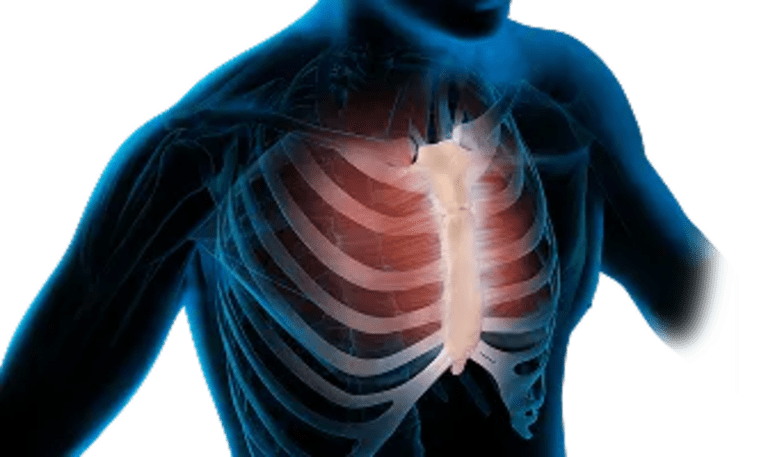 Cardiothoracic