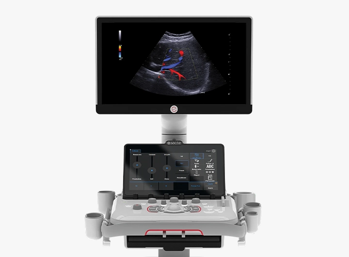 Esaote MyLab A50