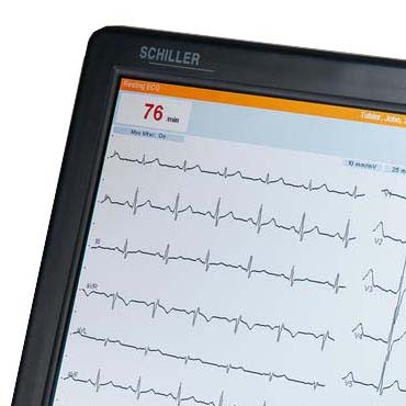Ruhe-EKG