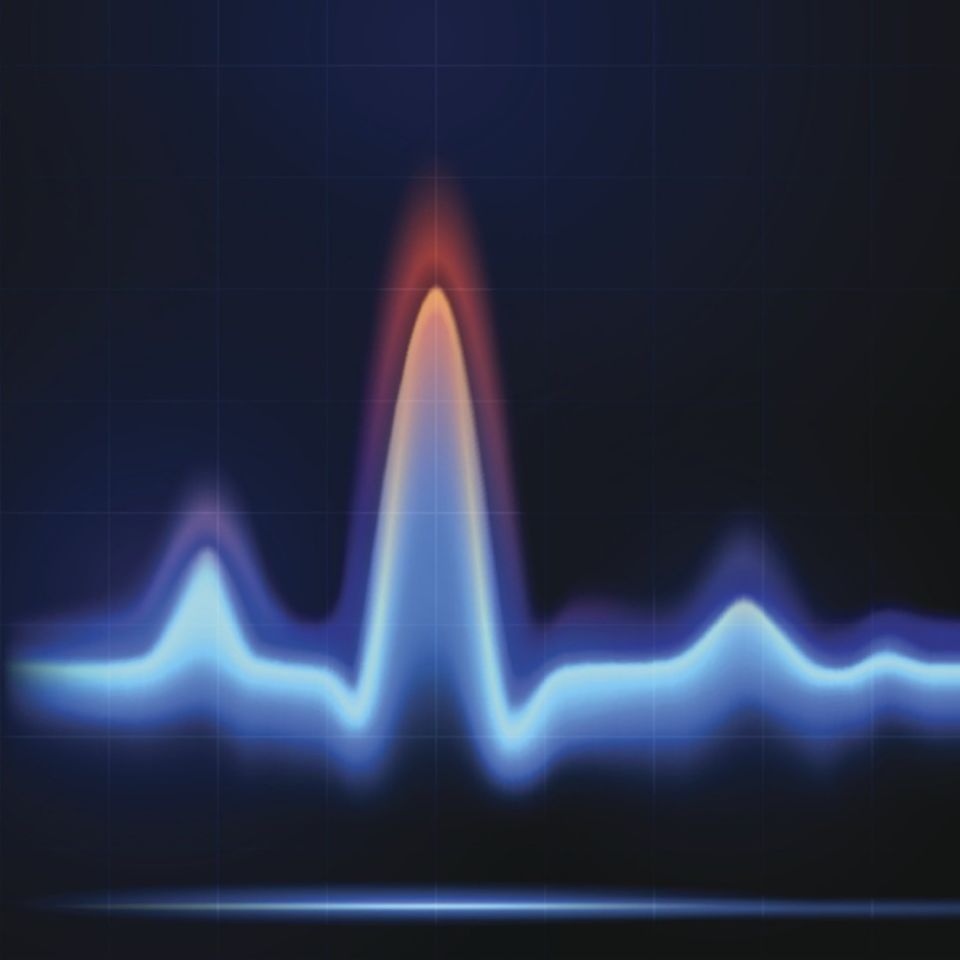 Korrelationskurve – Timing-Jitter-Charakterisierung