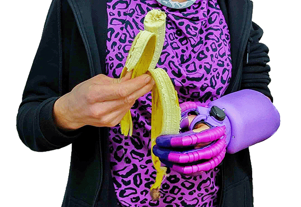 Anwenderin nutzt die exomotion® hand one im Alltag