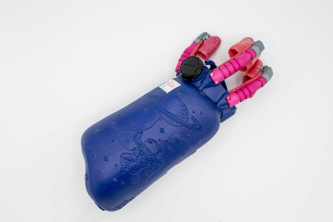 Prototyp der Kinderhandorthese