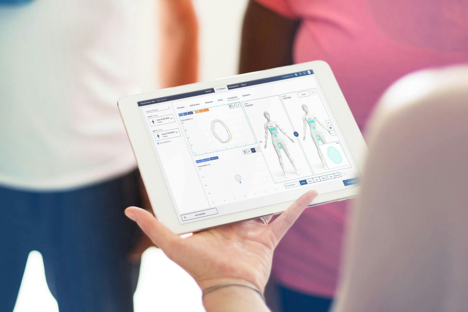 3D-Bodyscanner