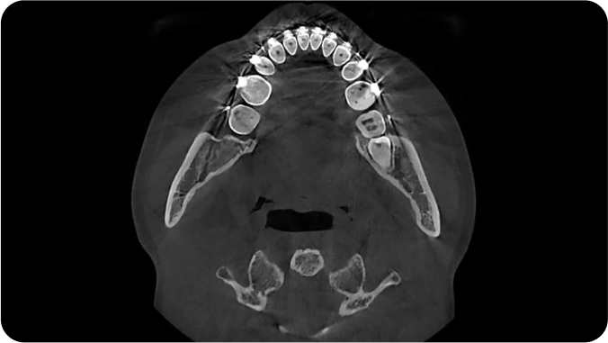 Dentale Bildgebung mit HDX WILL