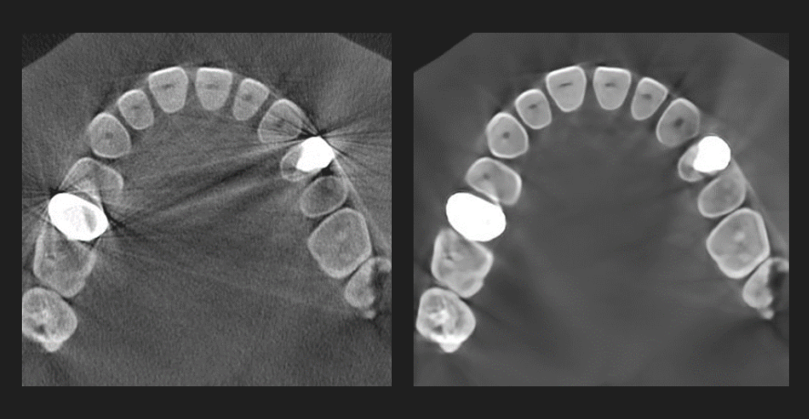 eco-x – CBCT (3D-Röntgen) mit AI, Wide FOV, AEC und Cephalometrie-Add-on