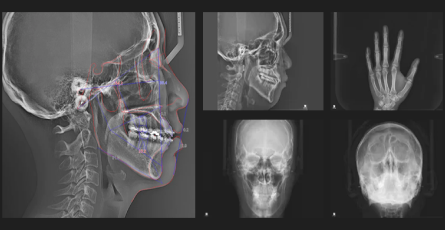 Real Arch – intraoraler 3D-Scanner mit leichtem Handstück