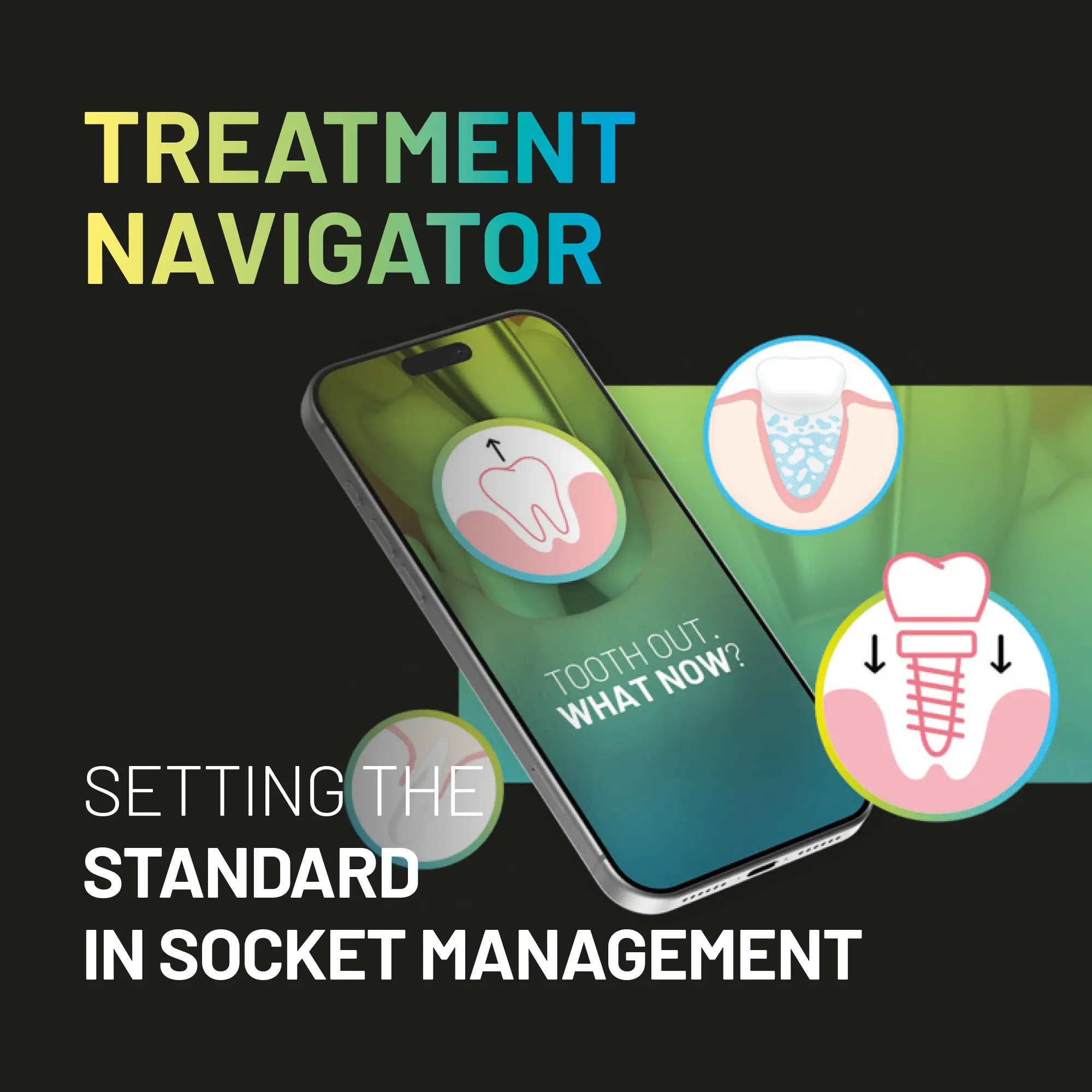 Socket Management