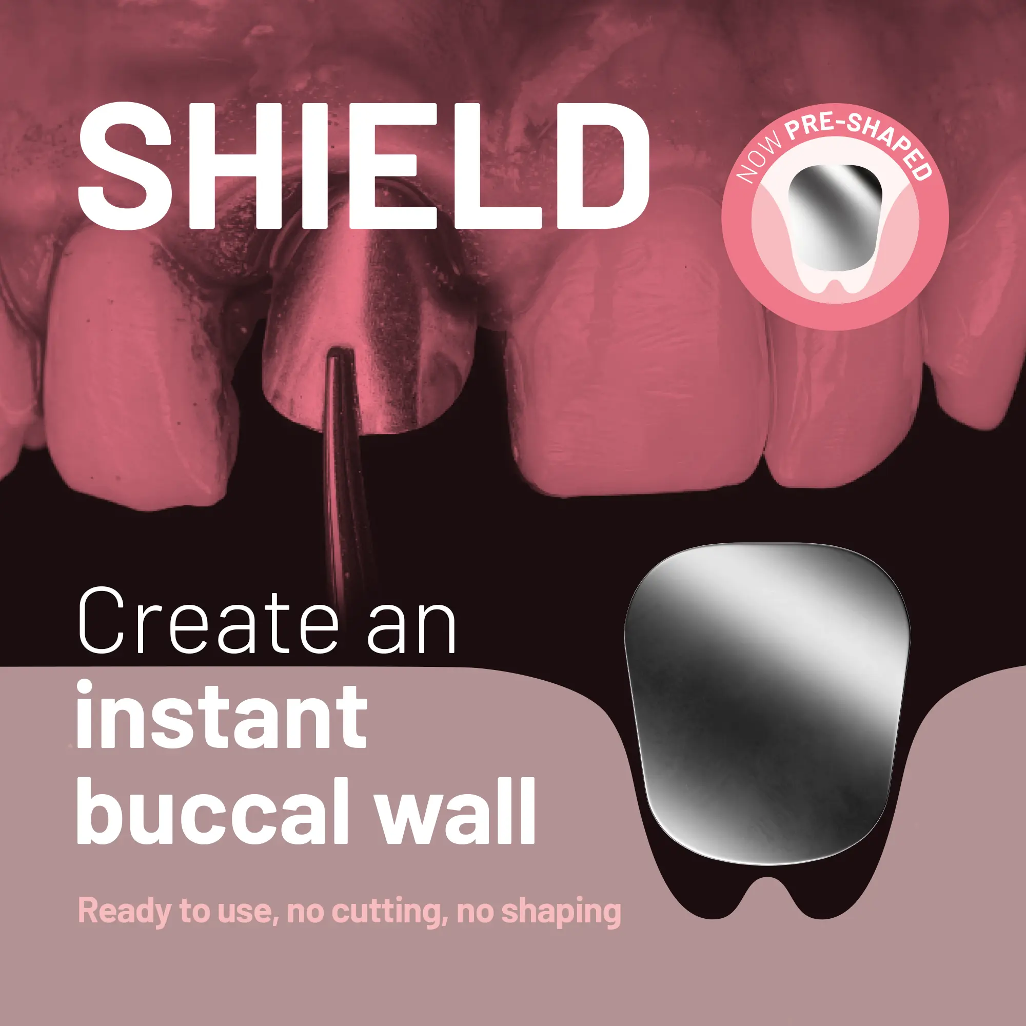 NOVAMag® SHIELD
